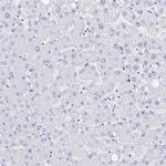 MEP1B Antibody in Immunohistochemistry (Paraffin) (IHC (P))