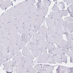 MEP1B Antibody in Immunohistochemistry (Paraffin) (IHC (P))