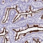 MEP1B Polyclonal Antibody