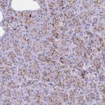 LYAG Polyclonal Antibody