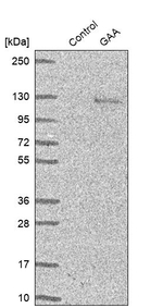 LYAG Antibody in Western Blot (WB)