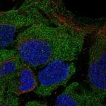 CD8 beta Antibody in Immunocytochemistry (ICC/IF)