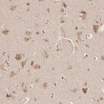 Apolipoprotein L6 Antibody in Immunohistochemistry (Paraffin) (IHC (P))