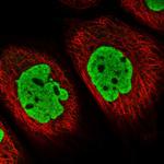 V-ATPase E1 Polyclonal Antibody