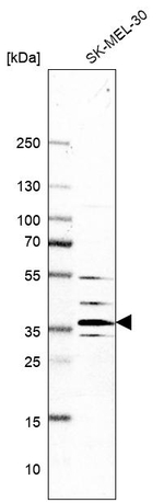V-ATPase E1 Antibody in Western Blot (WB)