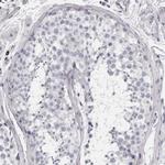 Granzyme H Antibody in Immunohistochemistry (Paraffin) (IHC (P))