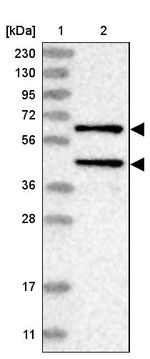 PPM1A Antibody in Western Blot (WB)