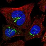 ZNF287 Polyclonal Antibody