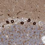 ITM2B Antibody in Immunohistochemistry (Paraffin) (IHC (P))