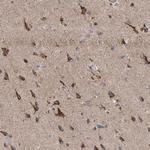 ITM2B Antibody in Immunohistochemistry (Paraffin) (IHC (P))