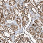 ITM2B Antibody in Immunohistochemistry (Paraffin) (IHC (P))