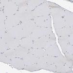 ITM2B Antibody in Immunohistochemistry (Paraffin) (IHC (P))