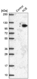 ACE Antibody in Western Blot (WB)