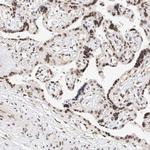 NRF1 Antibody in Immunohistochemistry (Paraffin) (IHC (P))