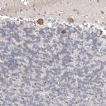 TCP-1 delta Antibody in Immunohistochemistry (Paraffin) (IHC (P))