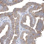 TCP-1 delta Antibody in Immunohistochemistry (Paraffin) (IHC (P))
