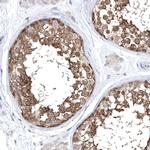 TCP-1 delta Antibody in Immunohistochemistry (Paraffin) (IHC (P))