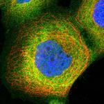 PIP5K1A Polyclonal Antibody