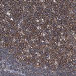 PIP5K1A Antibody in Immunohistochemistry (Paraffin) (IHC (P))