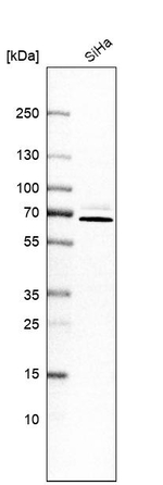 PIP5K1A Antibody in Western Blot (WB)