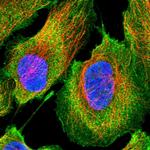 ETNK1 Polyclonal Antibody