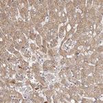 ETNK1 Antibody in Immunohistochemistry (Paraffin) (IHC (P))