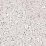 MEP1A Polyclonal Antibody