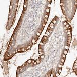 MEP1A Antibody in Immunohistochemistry (Paraffin) (IHC (P))