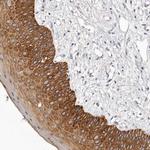 STK16 Antibody in Immunohistochemistry (Paraffin) (IHC (P))