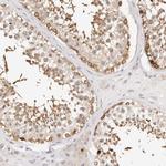 GGPS1 Polyclonal Antibody