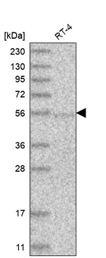 GGPS1 Antibody in Western Blot (WB)