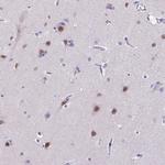 SATB2 Antibody in Immunohistochemistry (Paraffin) (IHC (P))