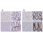 SATB2 Antibody in Immunohistochemistry (Paraffin) (IHC (P))