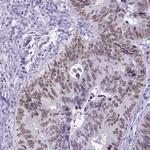 SATB2 Antibody in Immunohistochemistry (Paraffin) (IHC (P))