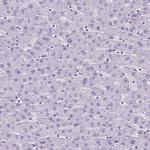 SATB2 Antibody in Immunohistochemistry (Paraffin) (IHC (P))