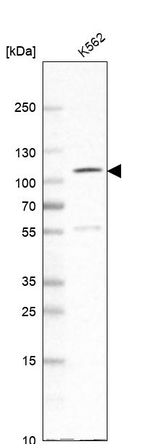 SATB2 Antibody in Western Blot (WB)