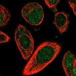 CHML Antibody in Immunocytochemistry (ICC/IF)