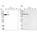 CHML Antibody in Western Blot (WB)