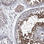 SIRT4 Antibody in Immunohistochemistry (Paraffin) (IHC (P))
