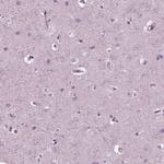CGA Antibody in Immunohistochemistry (Paraffin) (IHC (P))
