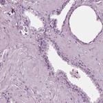 CGA Antibody in Immunohistochemistry (Paraffin) (IHC (P))