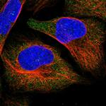 APEH Polyclonal Antibody