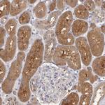 APEH Antibody in Immunohistochemistry (Paraffin) (IHC (P))