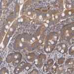 APEH Antibody in Immunohistochemistry (Paraffin) (IHC (P))
