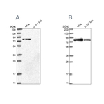 APEH Antibody in Western Blot (WB)