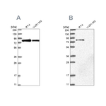 APEH Antibody in Western Blot (WB)