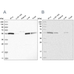 ALDH5A1 Antibody in Western Blot (WB)