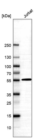 ALDH5A1 Antibody in Western Blot (WB)