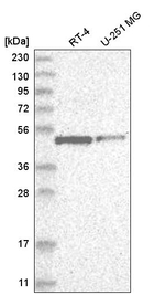 E2F1 Antibody in Western Blot (WB)