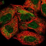 SLC22A3 Polyclonal Antibody